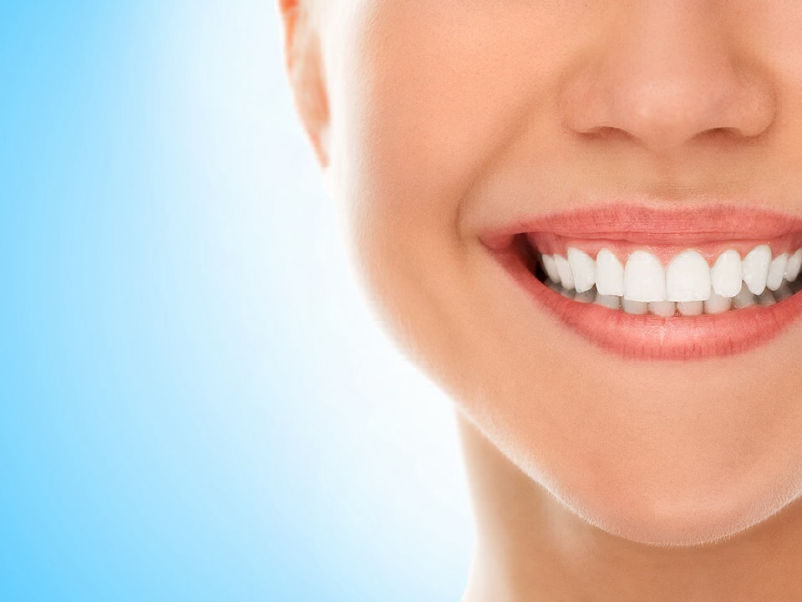 The benefits of dental implants